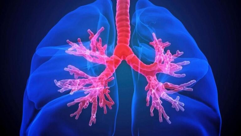 Ipertensione polmonare, cos’è e come si riconosce la malattia che “toglie” il respiro